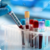 Blood-Based Biomarkers